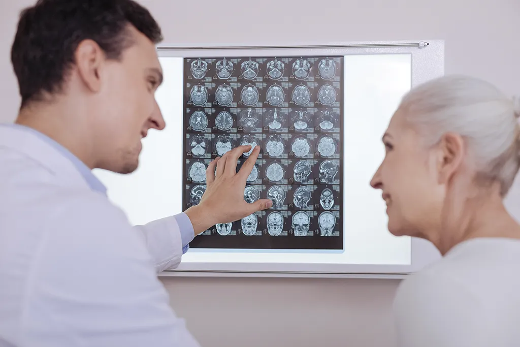 Primeros síntomas de un tumor cerebral | Early Symptoms of a Brain Tumor